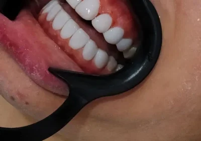 26