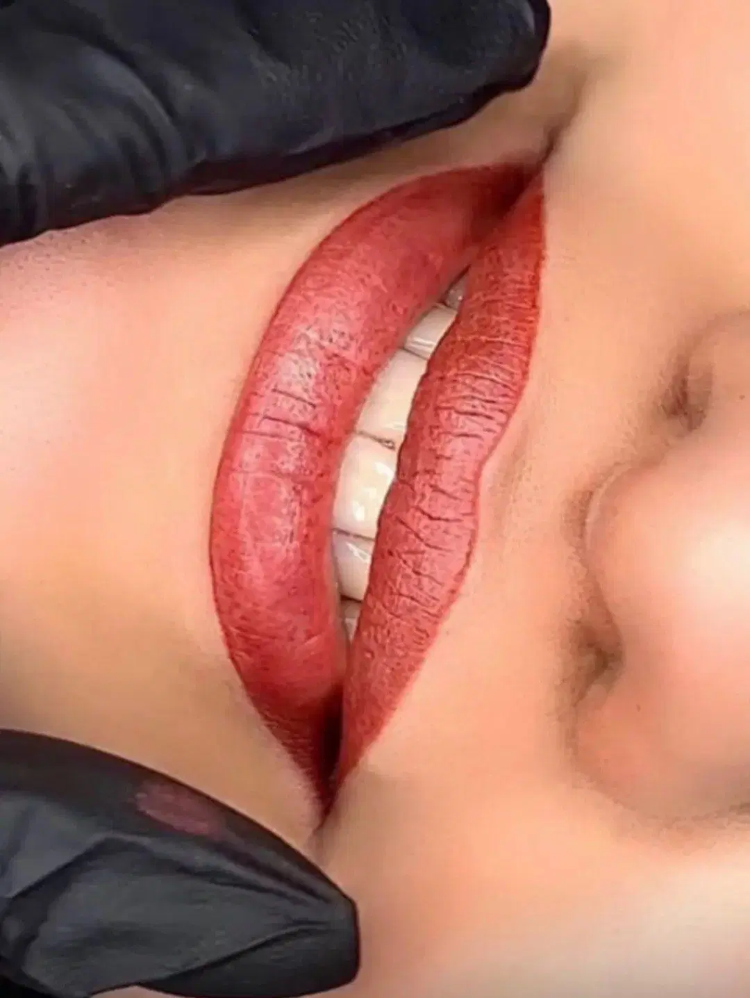 37